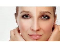 Whitening Creams