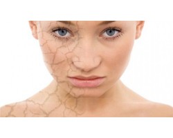 Intense moisturizing cream for sensitive skin